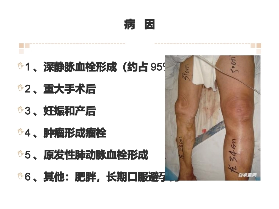 肺栓塞业务学习_第4页