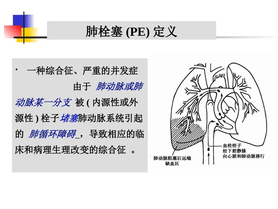 肺栓塞(本科讲义)_第13页