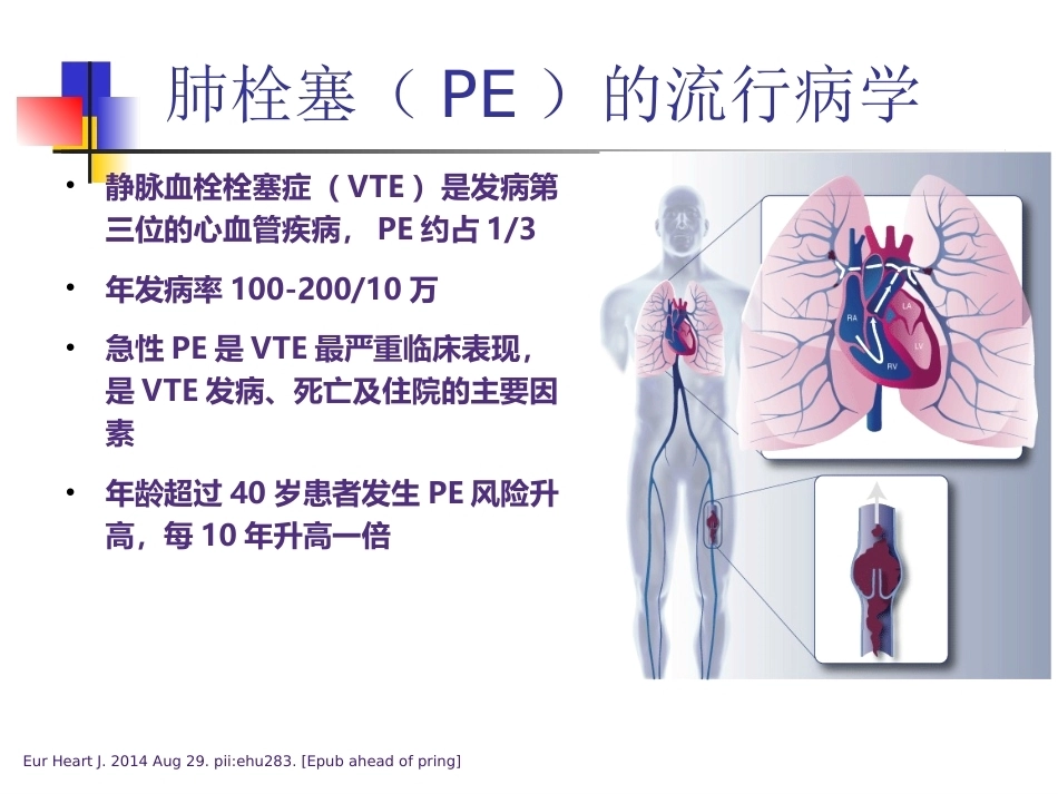 肺栓塞(本科讲义)_第7页