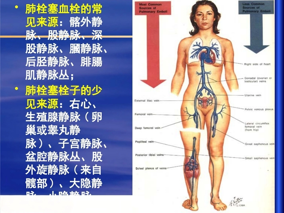 肺栓塞 (1)_第8页