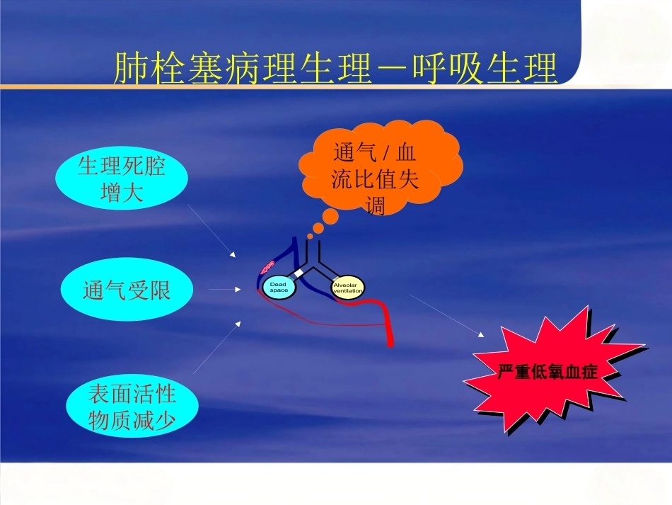 肺栓塞 (2)_第9页