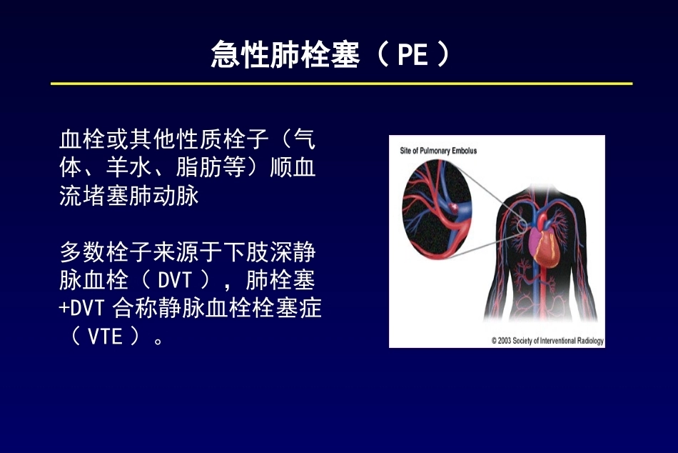 肺栓塞诊断及鉴别诊断3_第2页