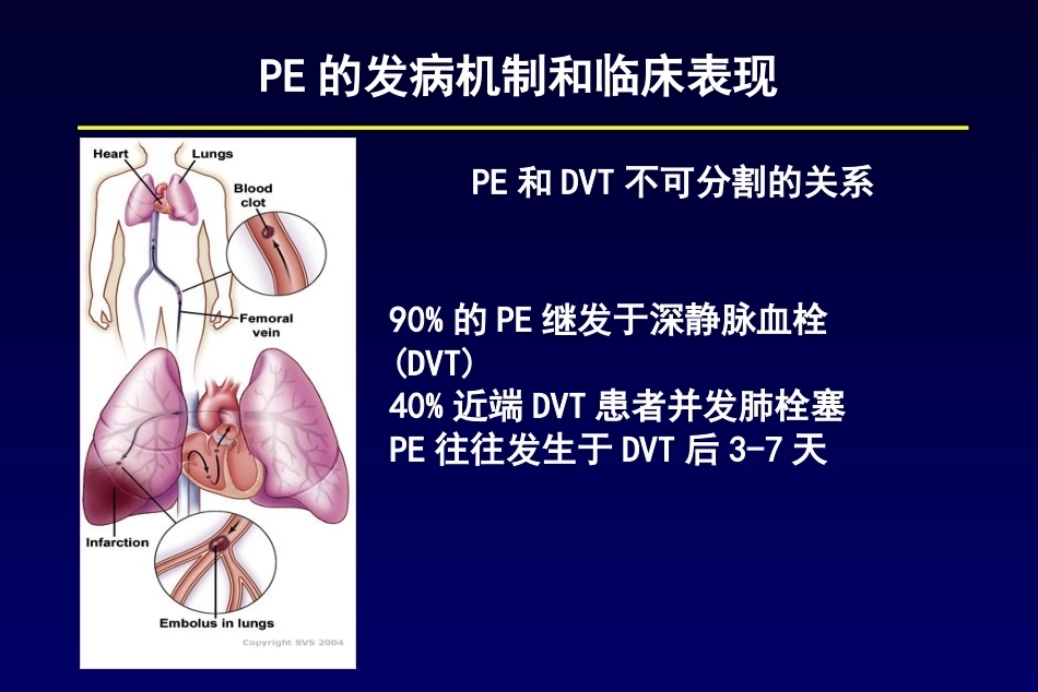 肺栓塞诊断及鉴别诊断3_第5页