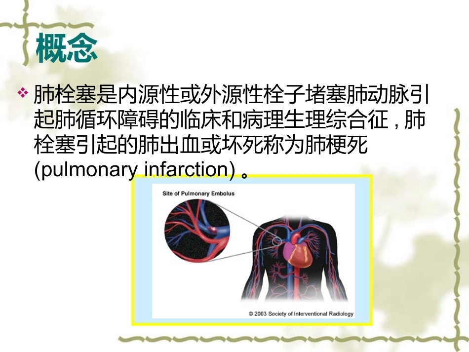 肺栓塞的诊断与治疗 PPT(3)_第2页