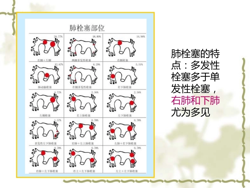 肺栓塞的诊断与治疗 PPT(3)_第9页