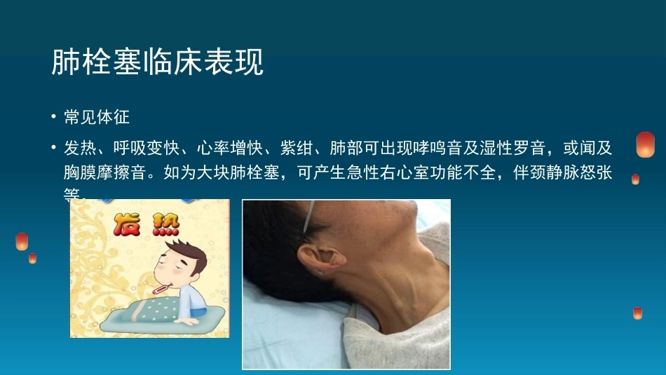 肺栓塞(6)_第6页
