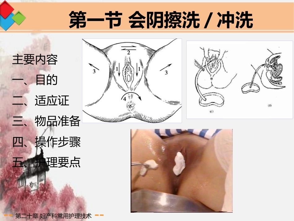 妇产科常用护理技术应用剖析_第5页