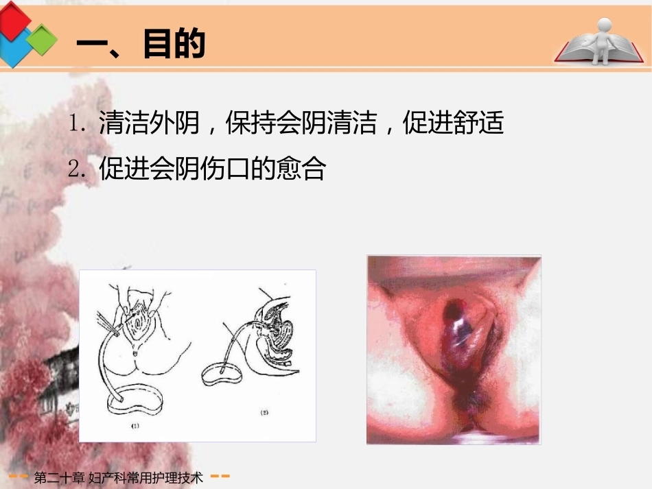 妇产科常用护理技术应用剖析_第6页