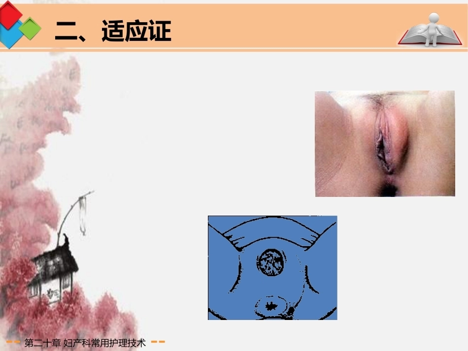 妇产科常用护理技术应用剖析_第7页
