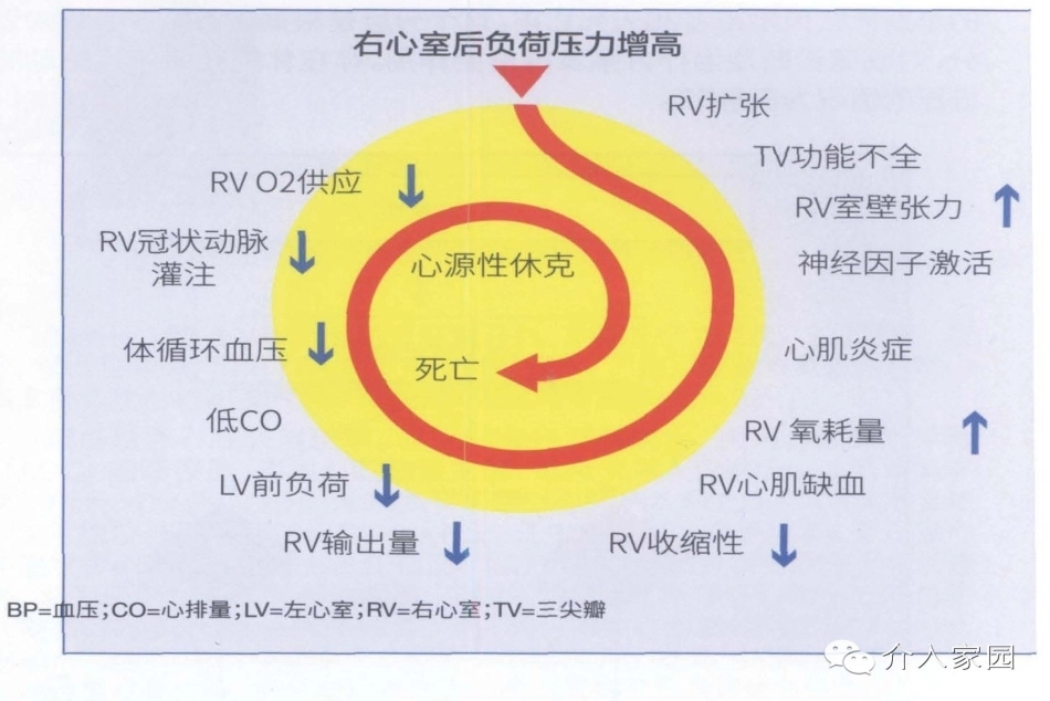 肺栓塞诊治7_第4页