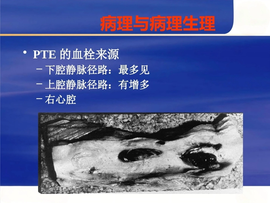 肺栓塞的诊断与治疗 PPT(8)_第7页