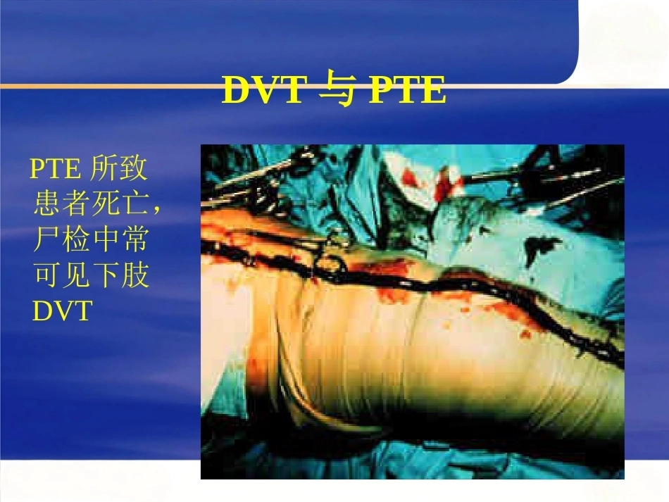 肺栓塞的诊断与治疗 PPT(8)_第8页