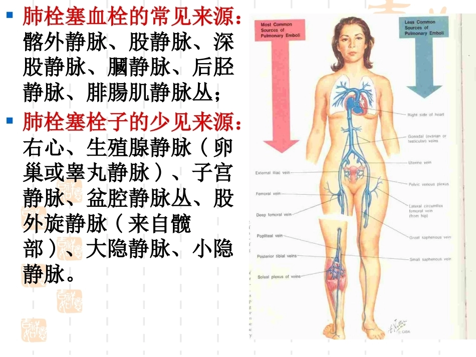 肺栓塞(9)_第10页