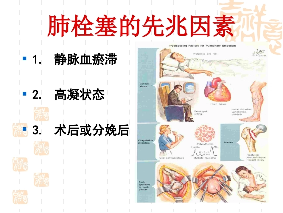肺栓塞(9)_第7页