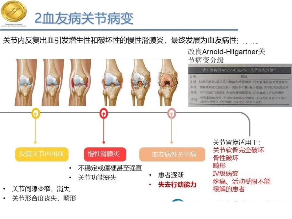 快速康复理念下10例甲型重型血友病膝关节炎患者围术期护理_第5页