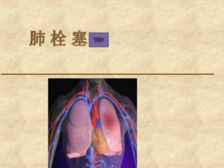 肺栓塞(13)