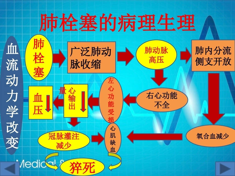 肺栓塞(13)_第12页