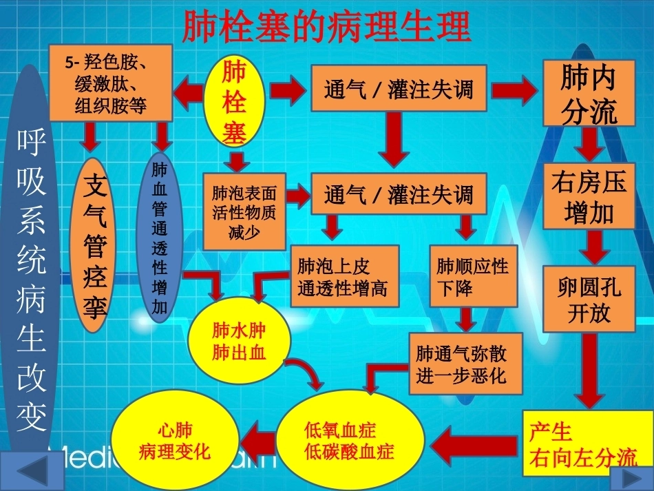 肺栓塞(13)_第13页