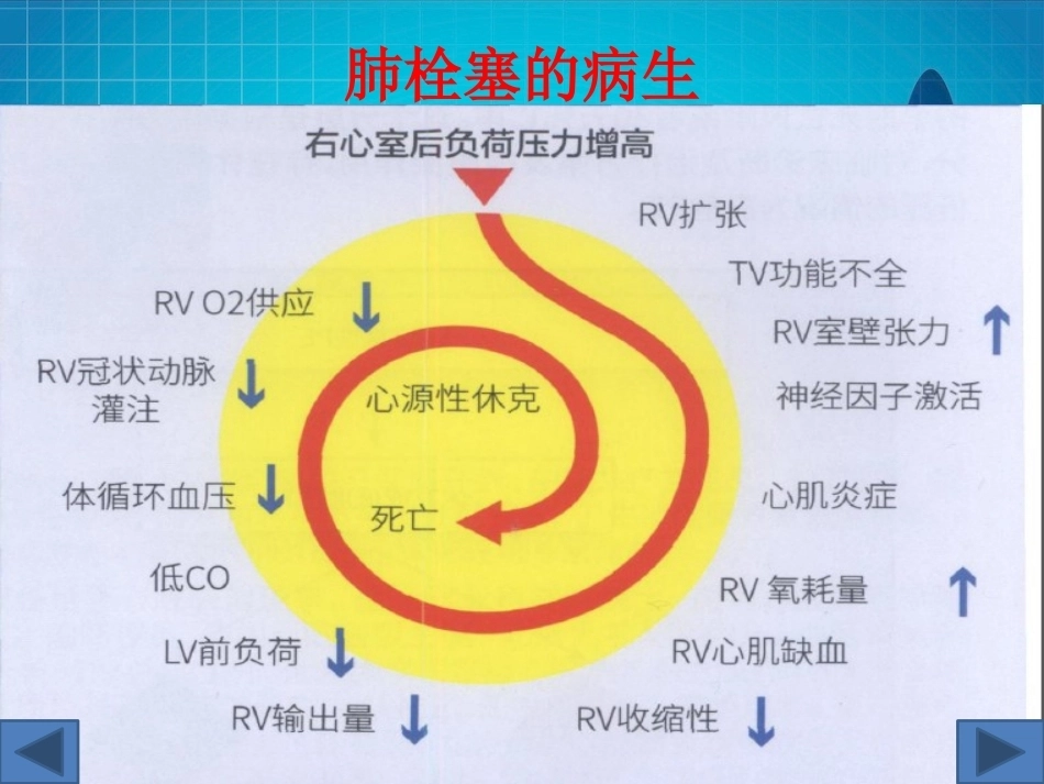 肺栓塞(13)_第14页