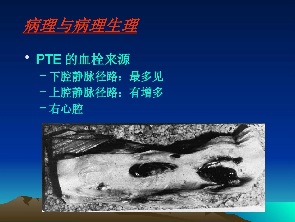 肺栓塞(16)_第6页