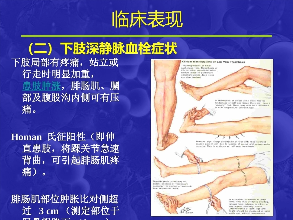 肺栓塞(19)_第10页