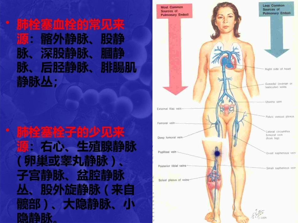 肺栓塞(19)_第5页