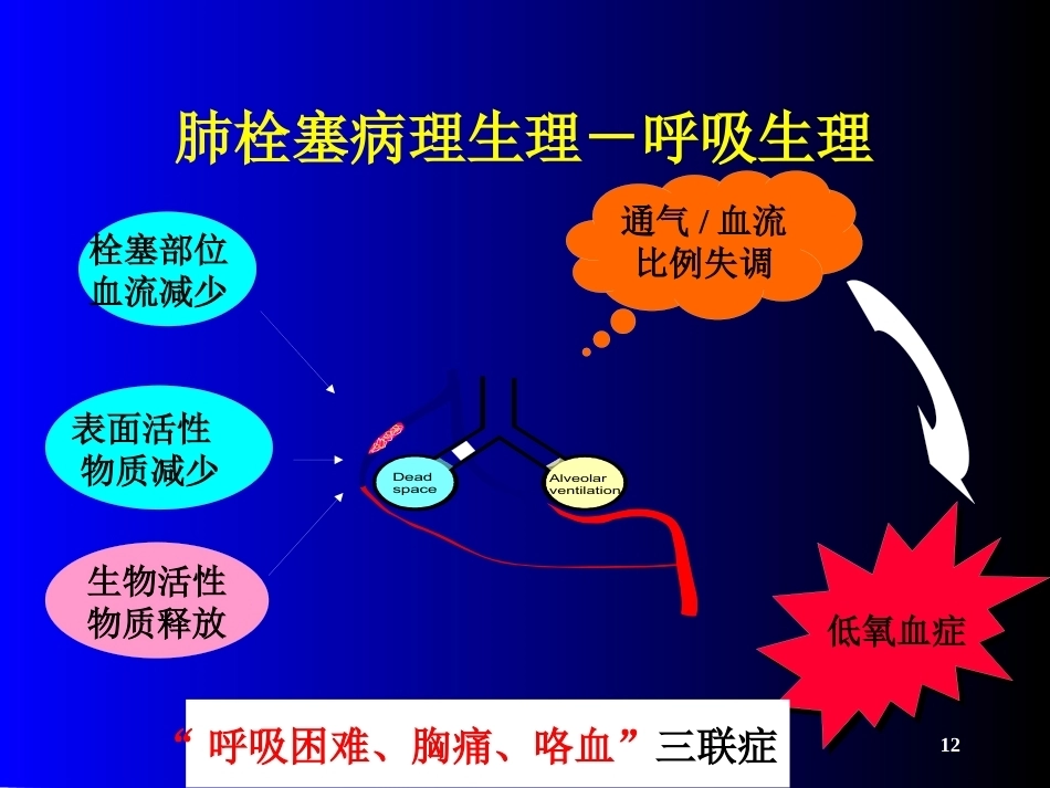 肺栓塞(21)_第12页