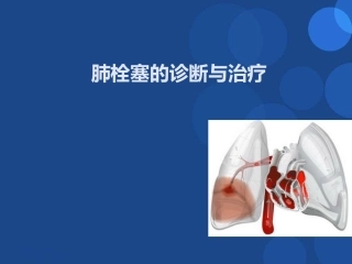 肺栓塞(22)