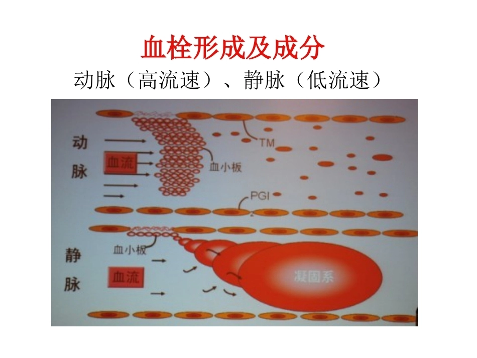 肺栓塞(24)_第4页