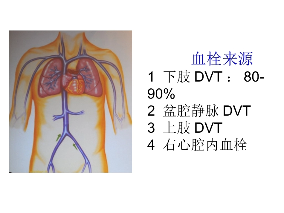 肺栓塞(24)_第9页