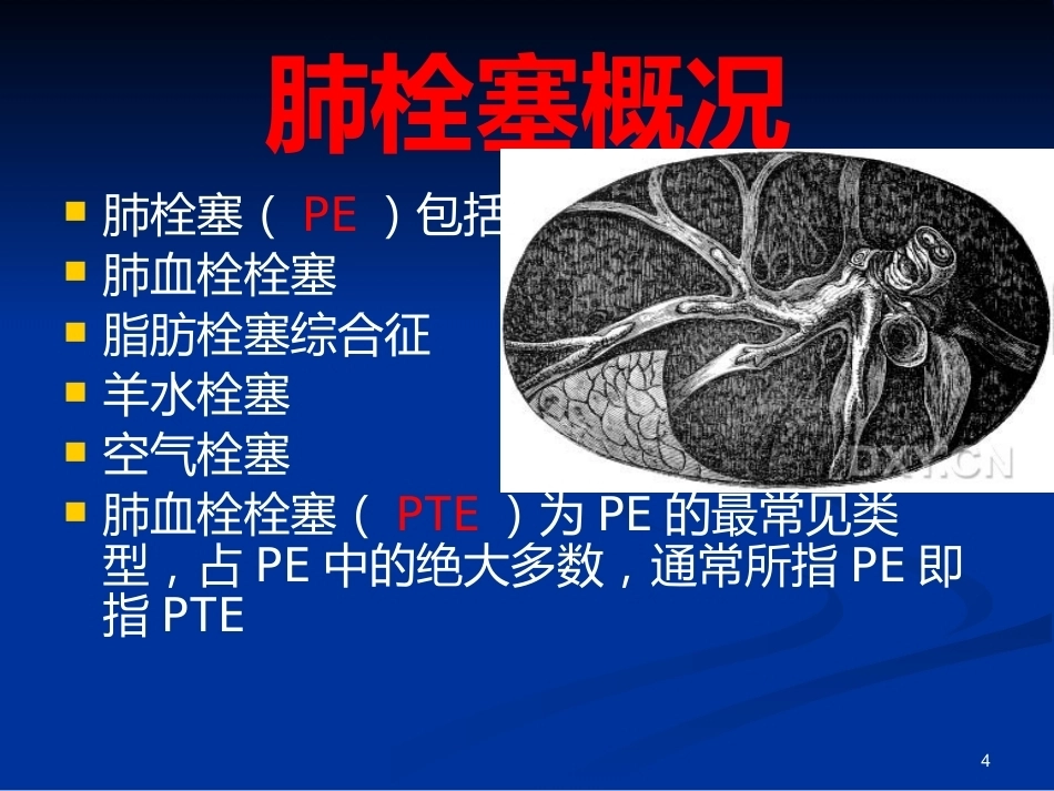 肺栓塞(25)_第4页