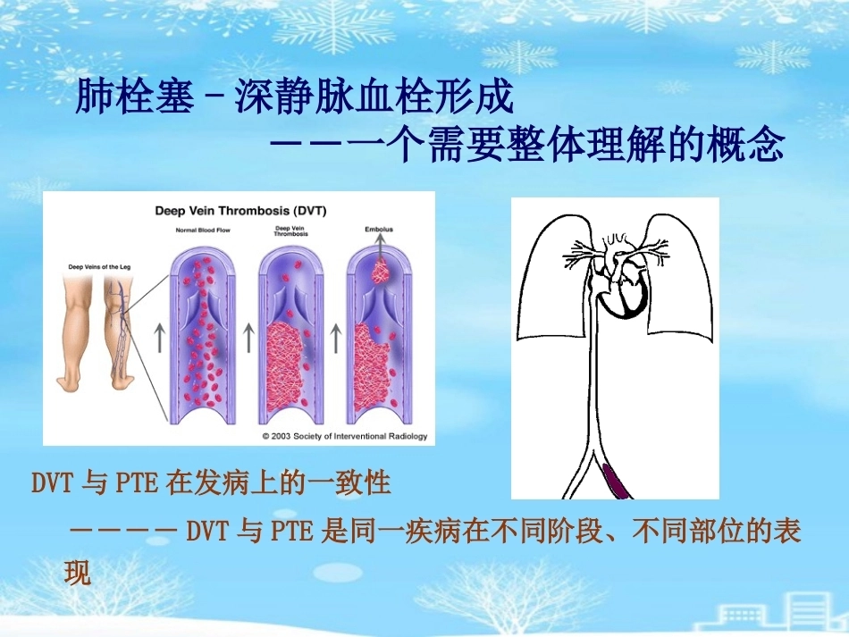 肺栓塞(27)_第5页