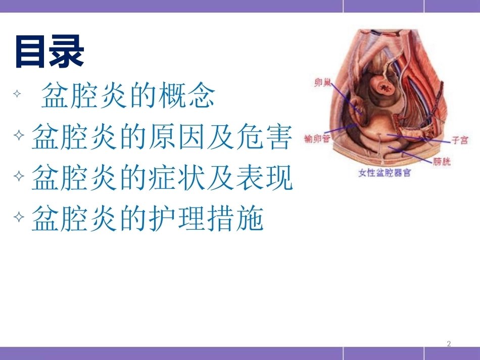 盆腔炎护理措施(妇产科)PPT_第2页