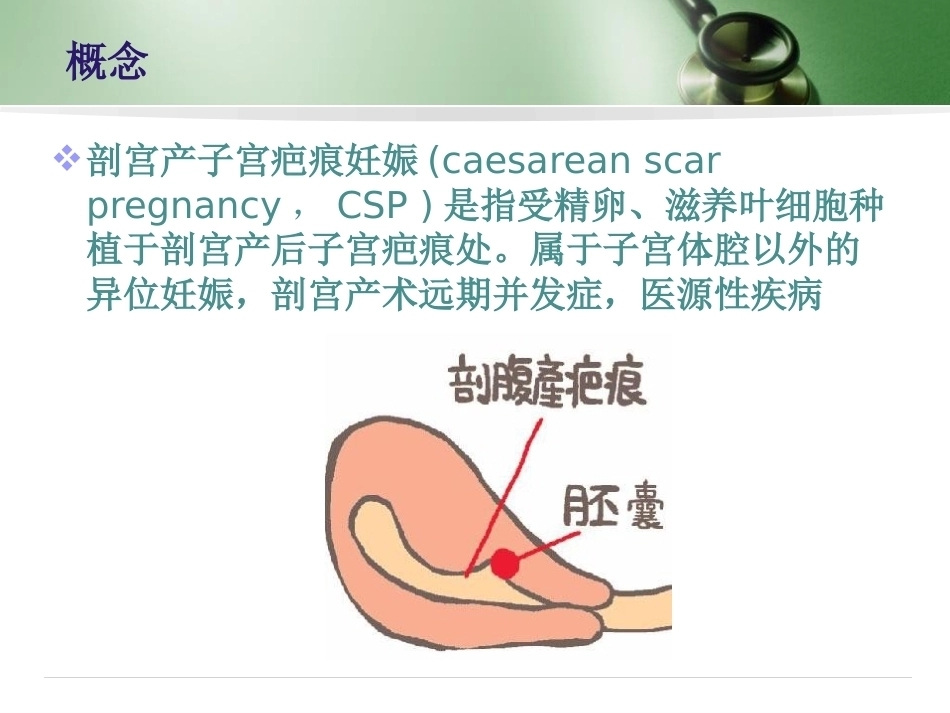 剖宫产子宫瘢痕妊娠_第4页