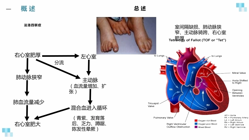 妊娠合并心脏病经典课件_第11页