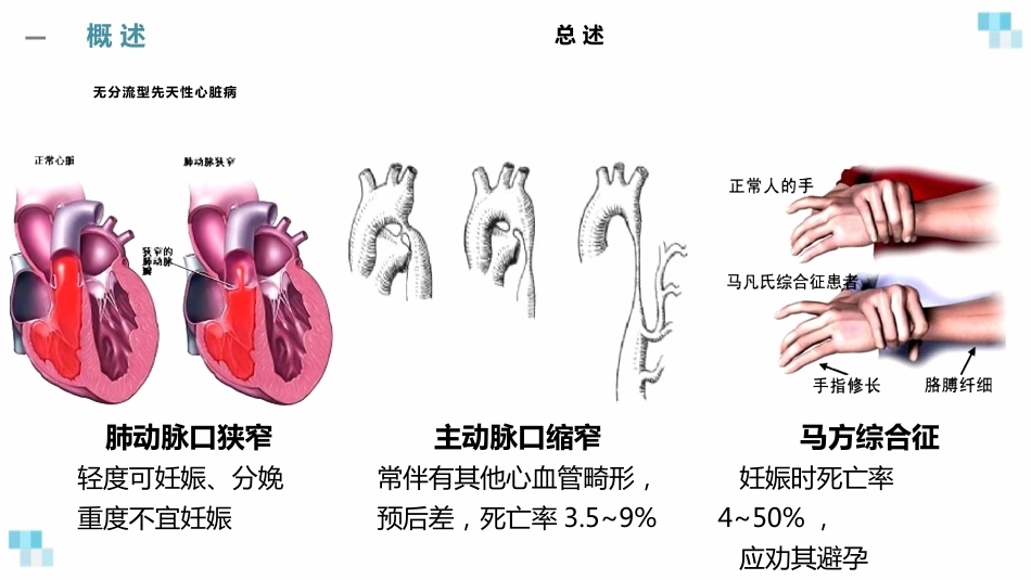 妊娠合并心脏病经典课件_第13页