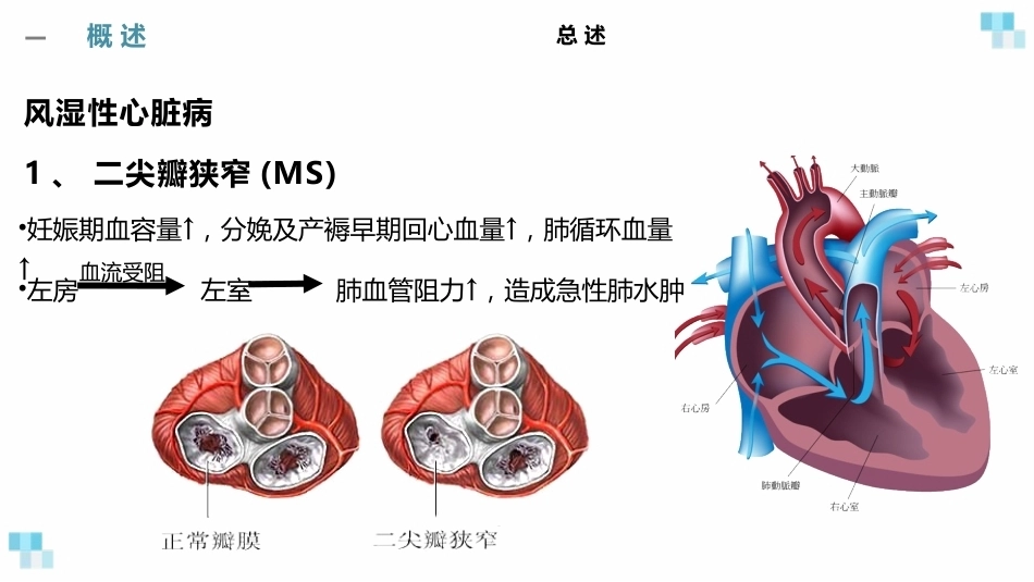 妊娠合并心脏病经典课件_第14页