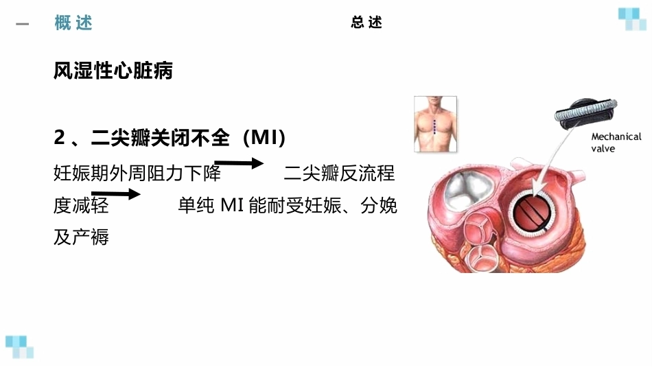 妊娠合并心脏病经典课件_第15页