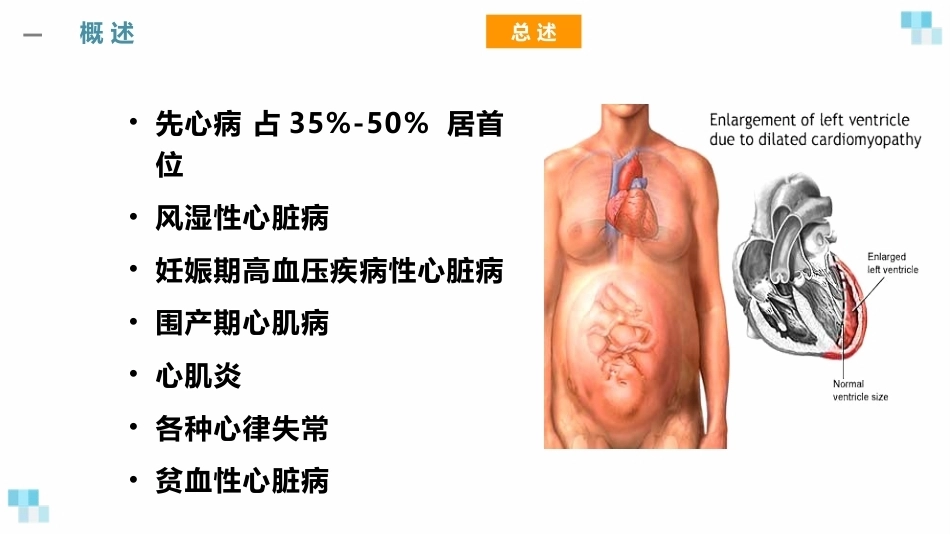 妊娠合并心脏病经典课件_第3页