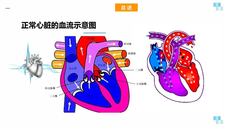 妊娠合并心脏病经典课件_第4页