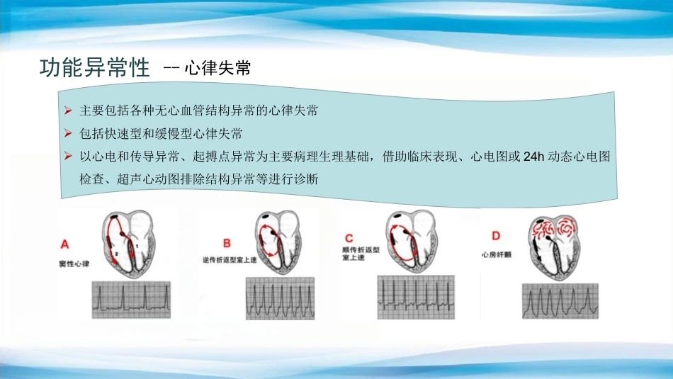 妊娠合并心脏病的诊治专家共识_第13页