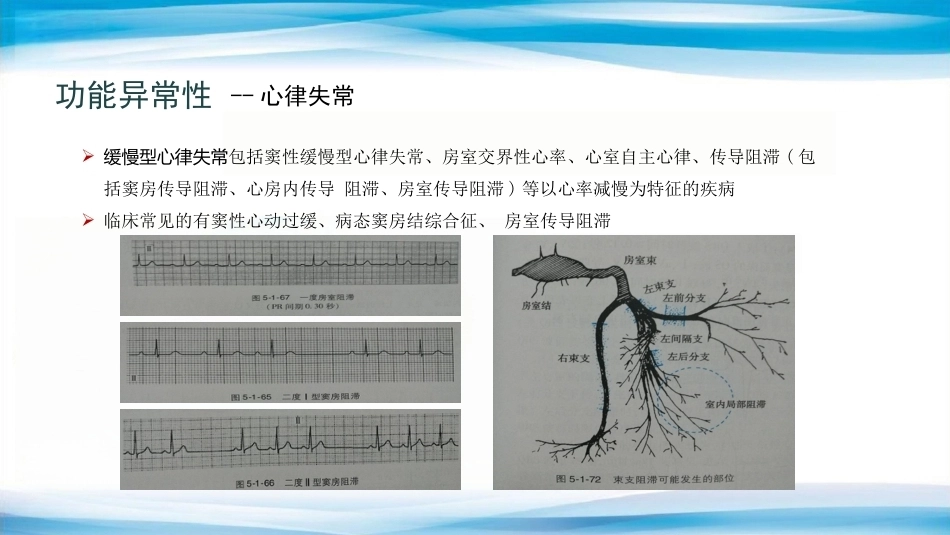 妊娠合并心脏病的诊治专家共识_第15页