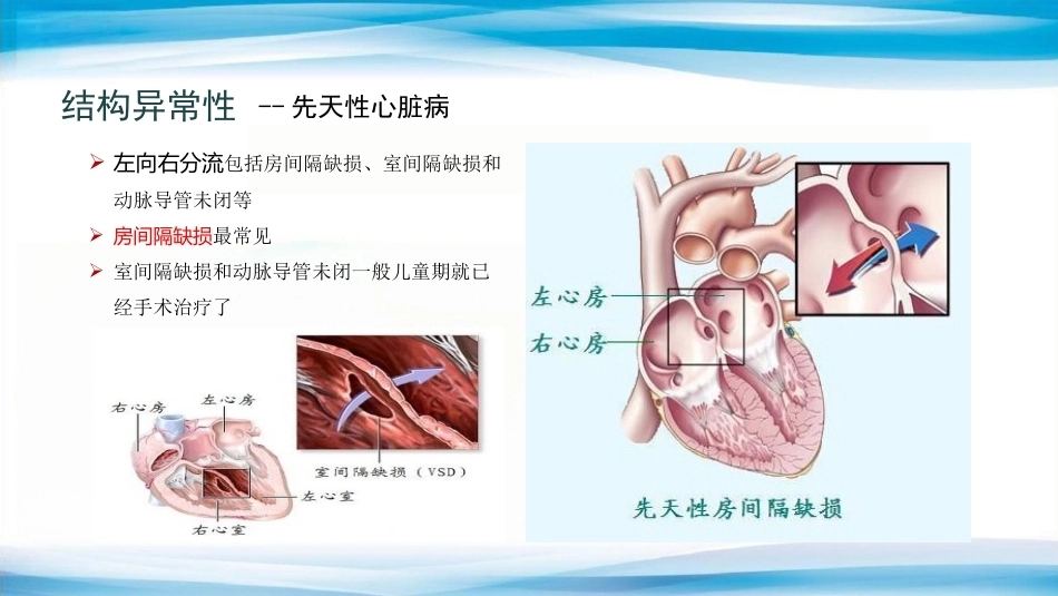 妊娠合并心脏病的诊治专家共识_第9页