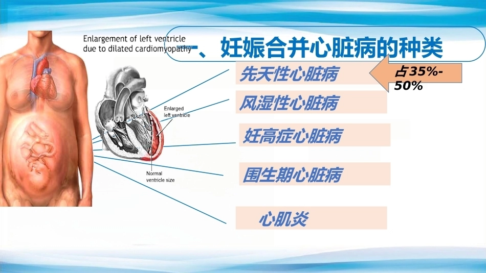 妊娠合并心脏病_第3页