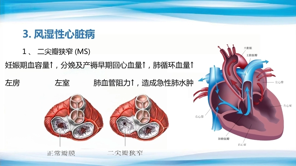妊娠合并心脏病_第6页