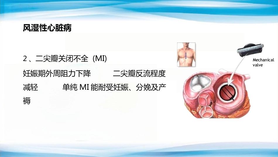 妊娠合并心脏病_第7页