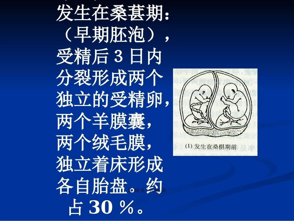 双胎妊娠与巨大胎儿PPT学习教案_第10页