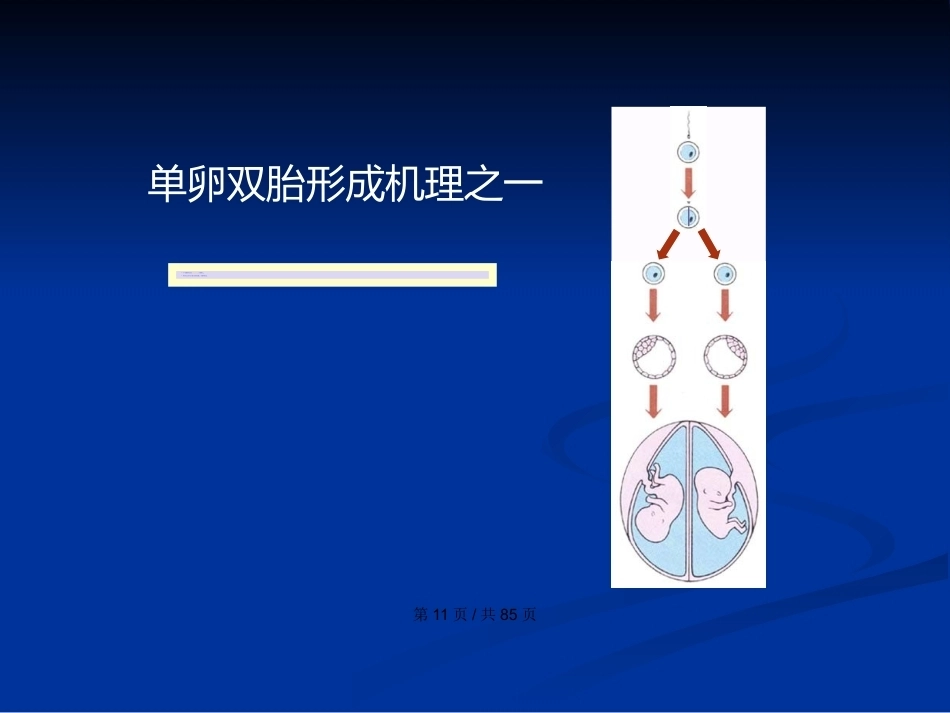 双胎妊娠与巨大胎儿PPT学习教案_第11页