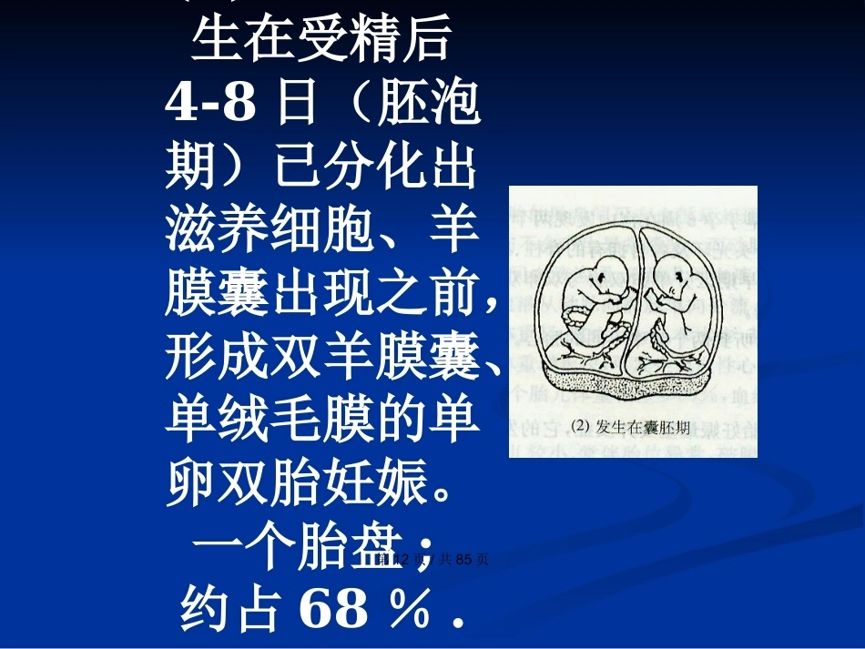 双胎妊娠与巨大胎儿PPT学习教案_第12页