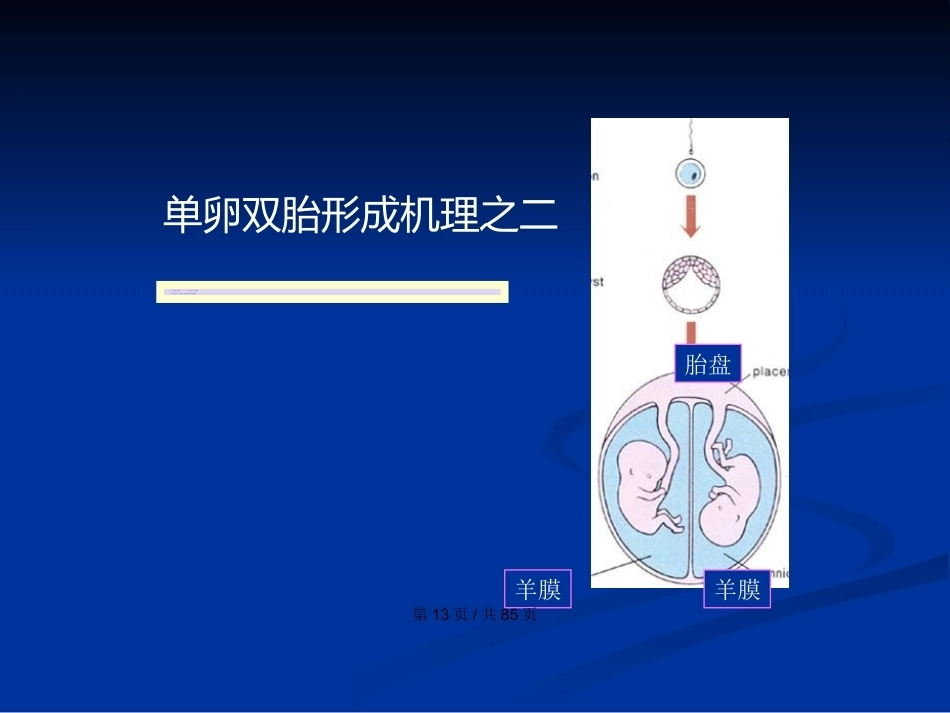 双胎妊娠与巨大胎儿PPT学习教案_第13页